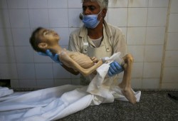 استشهاد طفل بسبب الجوع في غزة