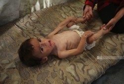 122 شهيدًا منهم 83 طفلا بجريمة الاحتلال في تجويع غزة