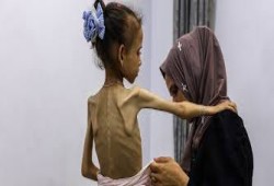 غزة تتصدر قائمة الجوع العالمي وسط حرب إبادة وحصار خانق