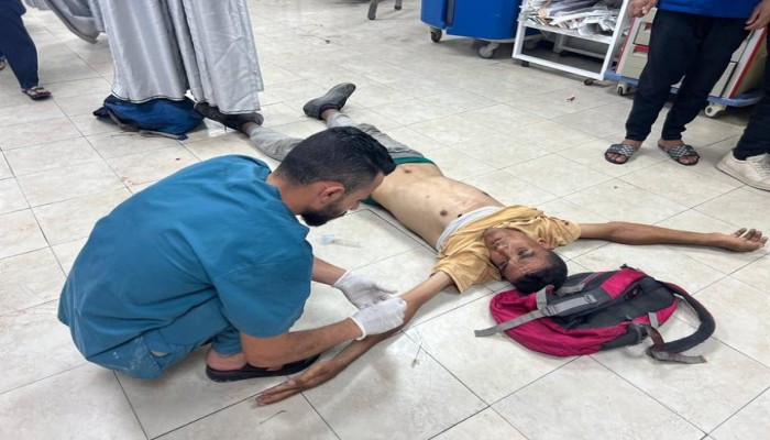 16 شهيدا وإصابات باستهداف الاحتلال منتظري المساعدات جنوب وشمال غزة