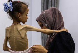 مؤشرات الغذاء في قطاع غزة تتجاوز عتبات المجاعة