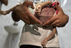 استشهاد 7 فلسطينيين جوعا في غزة والعدد يرتفع إلى 154