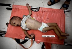 استشهاد الطفل أحمد عبد العال جوعا في خانيونس بغزة