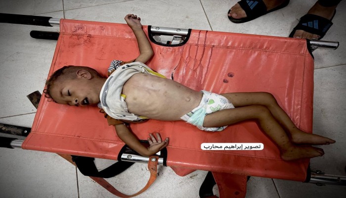 استشهاد الطفل أحمد عبد العال جوعا في خانيونس بغزة