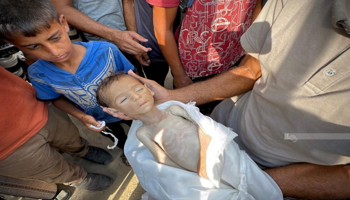 6 شهداء بالتجويع الصهيوني في غزة خلال24 ساعة