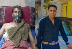 أنور بسيسة.. رصاص الاحتلال يحيله مقعدًا أثناء بحثه عن طعام أطفاله