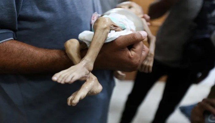 28 طفلا يستشهدون بغزة يوميا جراء القصف والتجويع