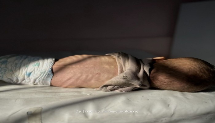 استشهاد 6 فلسطينيين جوعا في غزة بينهم طفلان