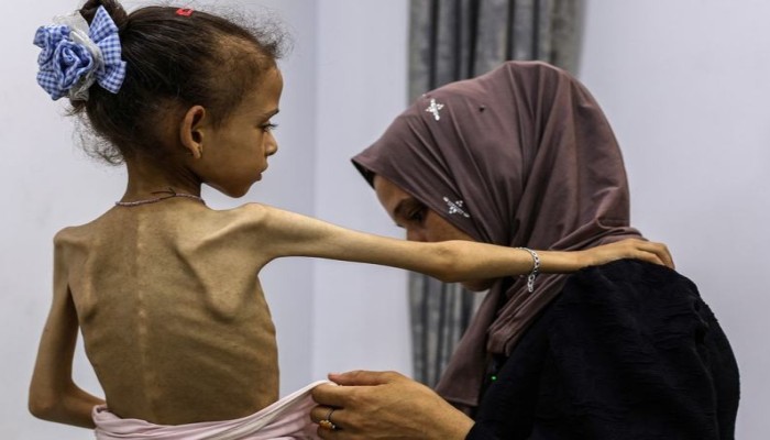 أونروا: يمكن وقف المجاعة في غزة بإدخال المساعدات فورا