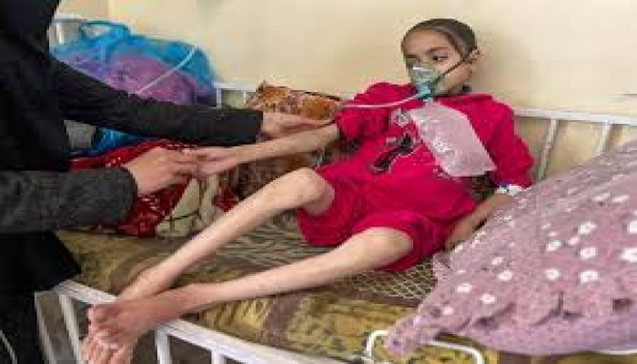 ارتفاع عدد ضحايا التجويع الصهيوني في غزة إلى 289 شهيداً