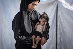 4 شهداء اليوم بسبب التجويع في غزة والعدد يرتفع إلى317