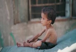 10 شهداء بالتجويع الصهيوني في غزة خلال 24 ساعة