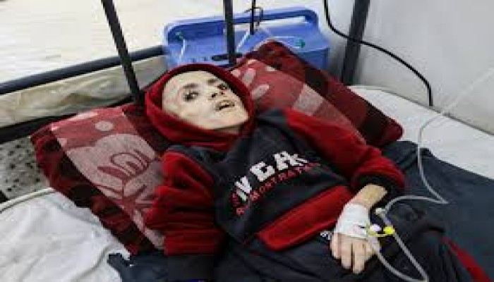 6 شهداء جوعا اليوم في غزة