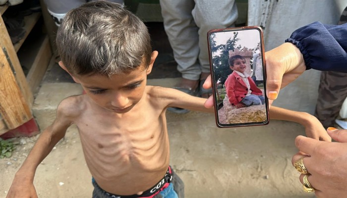 3 شهداء جوعا في غزة خلال 24 ساعة