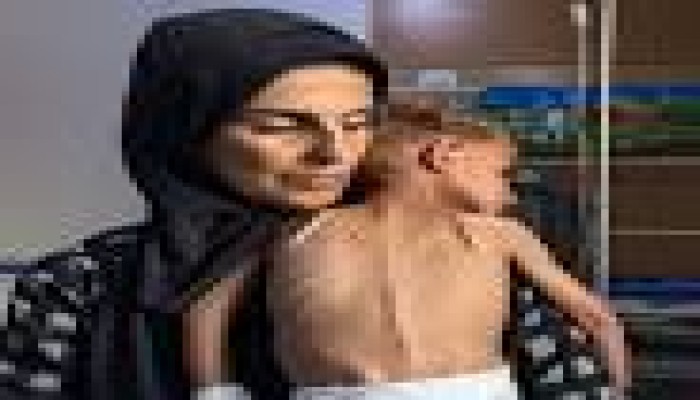 الصحة العالمية تحذر من استمرار المجاعة في غزة