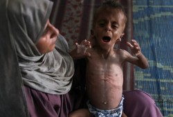 5 شهداء جوعا اليوم في غزة بينهم 3 أطفال