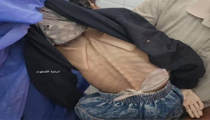 الأمم المتحدة: الفرصة ضئيلة لوقف المجاعة في غزة