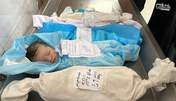 شهادة طبيب إسباني على جرائم قتل الاحتلال للأطفال بغزة