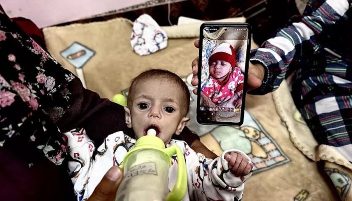 الاحتلال يعرقل دخول 938 ألف عبوة حليب لأطفال غزة