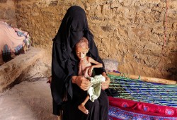 تفاقم انعدام الأمن الغذائي في اليمن