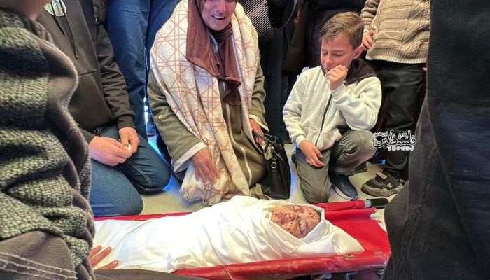 651 شهيدًا و1,741 مصابًا في غزة منذ إعلان وقف إطلاق النار