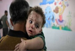 الجدري ينهش أجساد الأطفال في غزة.. الأزمة الصحية تتفاقم