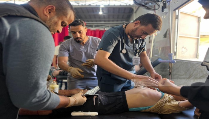 32 شهيدًا ومصابا بمستشفيات غزة خلال 48 ساعة
