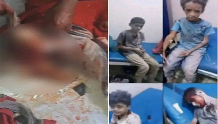 5شهداء مدنيين في اليمن جراء قصف الانقلابيين لمدينة تعز